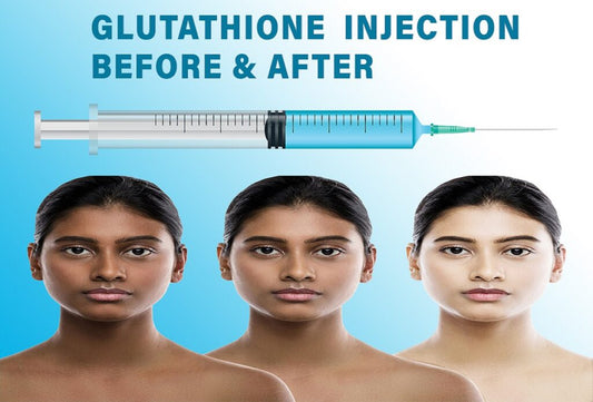 GLUTATHIONE WHITENING INJECTIONS FULL KIT